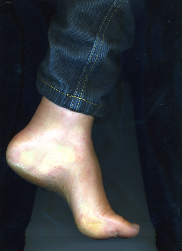 20-pied